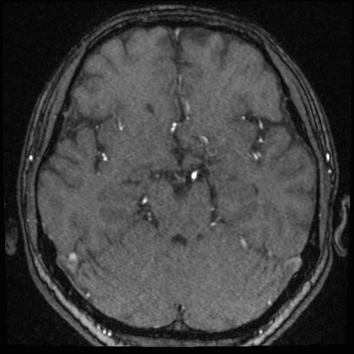 Click on the Serie image to view the images of VILLANUEVA, WILLIAM A.